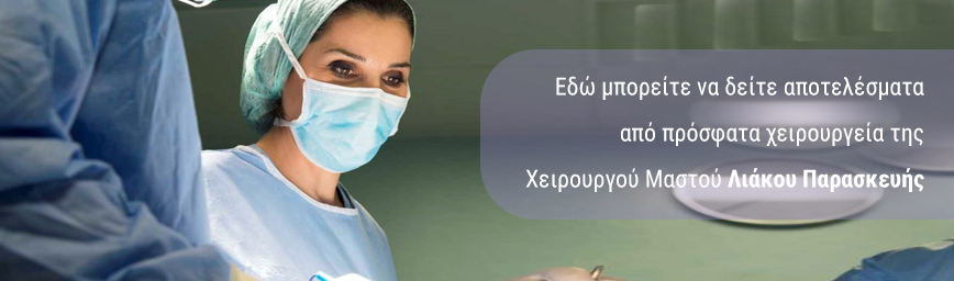 Λιακουπαρασκευη